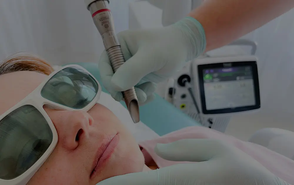 Laserov&eacute; omlazen&iacute; pleti FOTONA