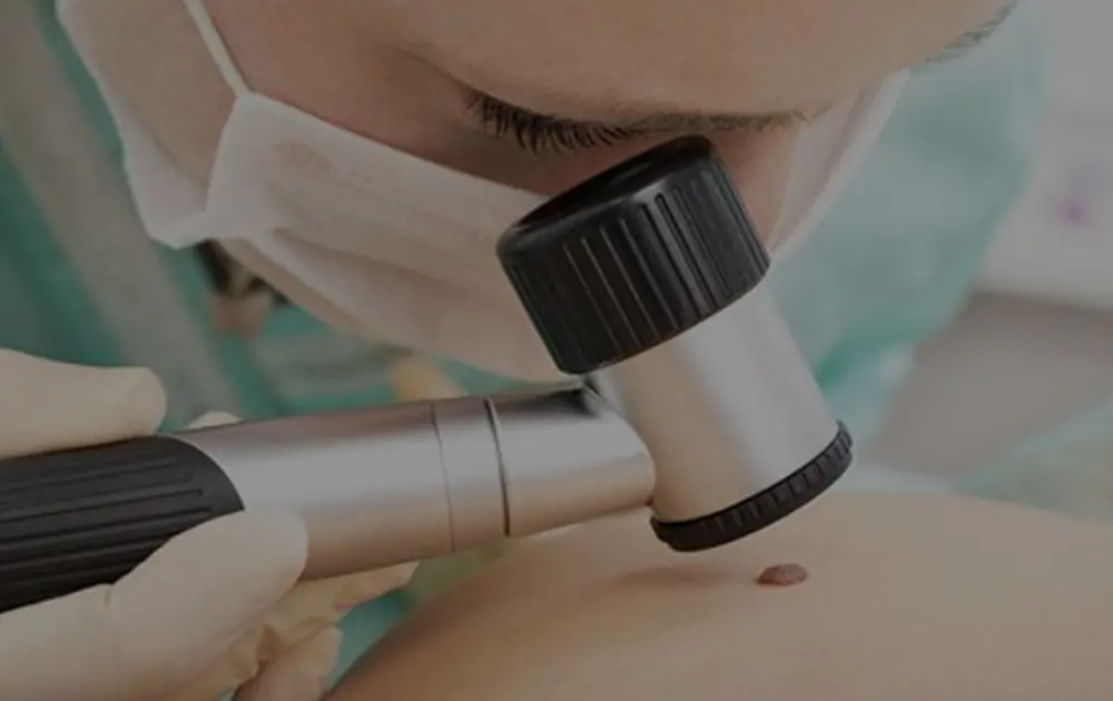 Odstraněn&iacute; znam&eacute;nek<br> a kožn&iacute;ch v&yacute;růstků